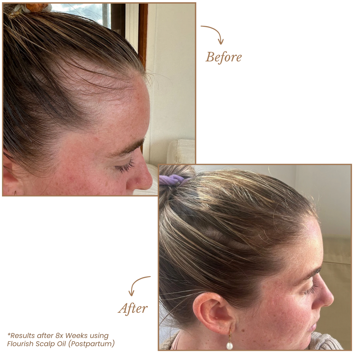 Flourish Scalp & Hair Pre-Wash Oil